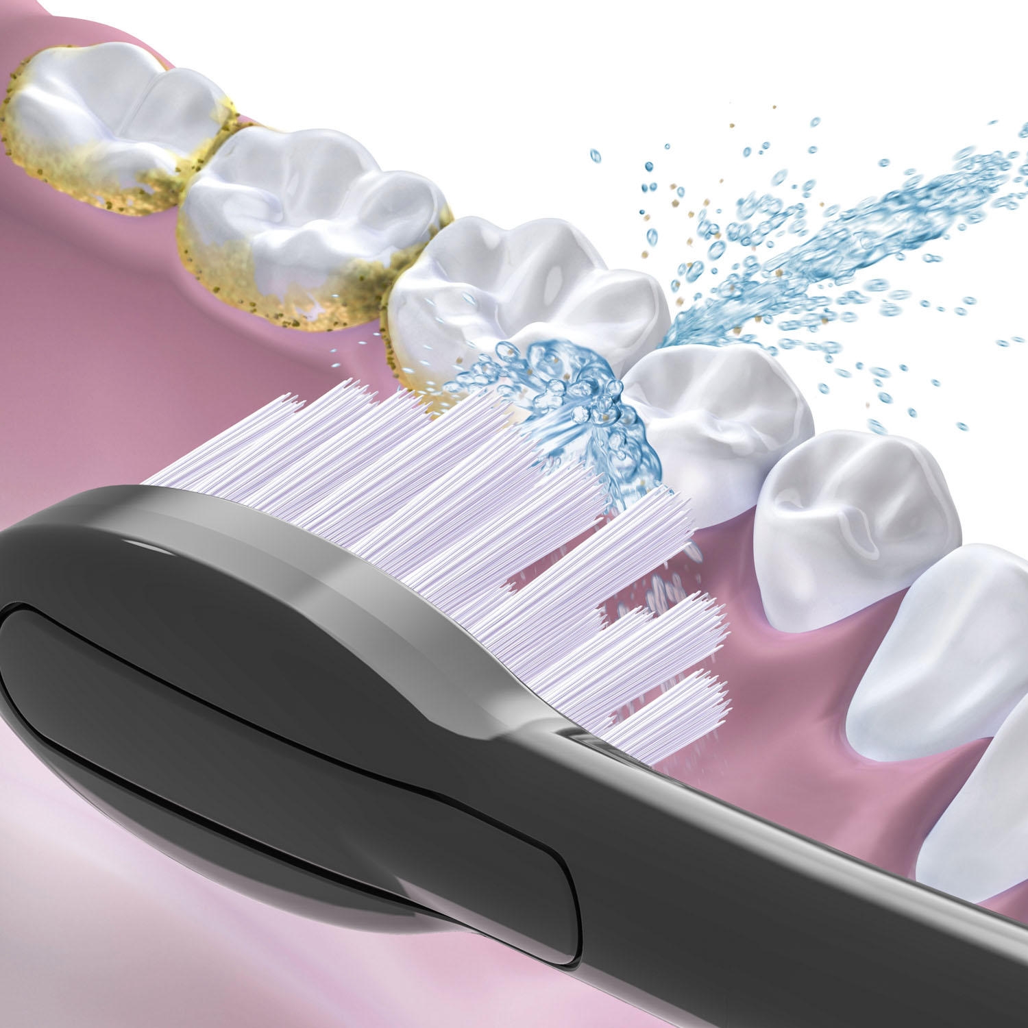 Waterpik Sonic-Fusion Full-Size Replacement Flossing Toothbrush Heads, Choose Color, 6 pk. - Image 6