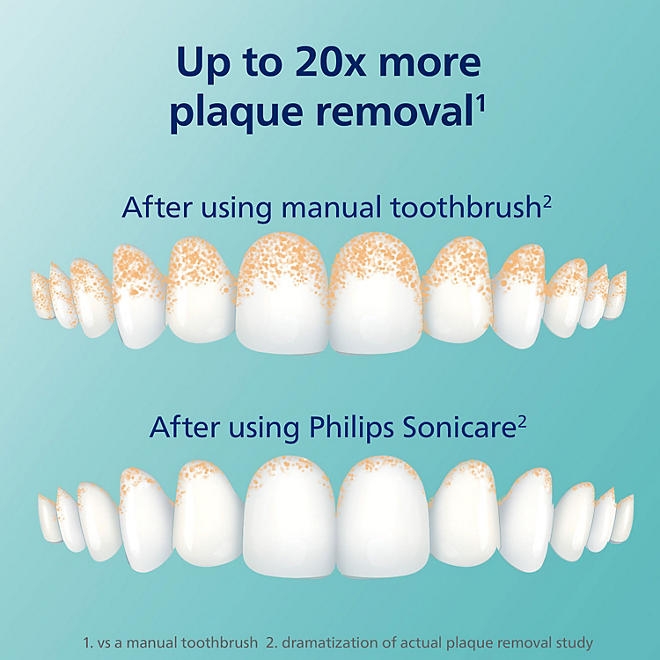 Philips Sonicare Prestige 9900 Power Toothbrush, Champagne, with Replacement Brush Heads - Image 11