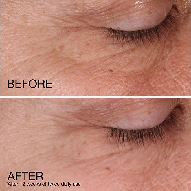 Neutrogena Rapid Wrinkle Repair Retinol Regenerating Cream, 1.7 oz., 2 pk. - Image 4