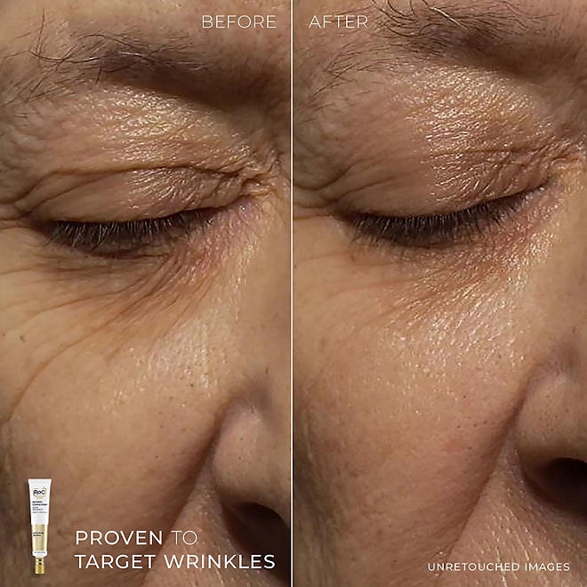 RoC Retinol Deep Wrinkle Serum & Night Cream Kit - Image 7