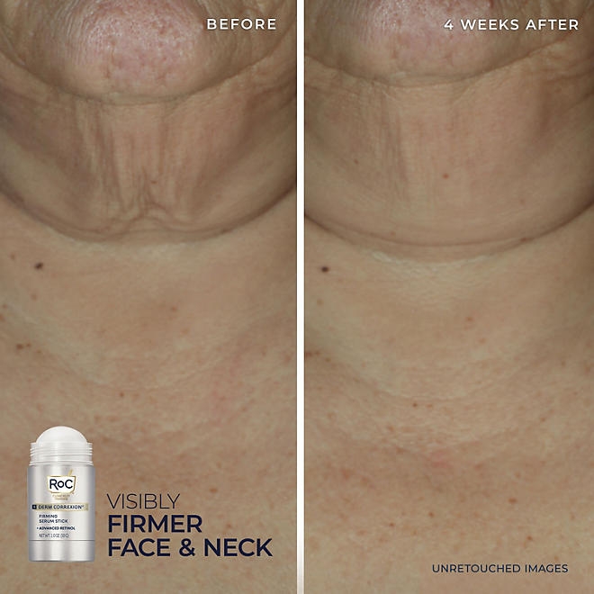 RoC Derm Correxion Firming Serum Stick and Contour Cream Kit - Image 5